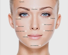Woman's face with cosmetic concerns labeled
