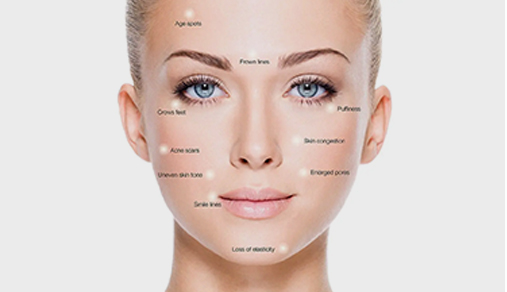 Woman's face with cosmetic concerns labeled