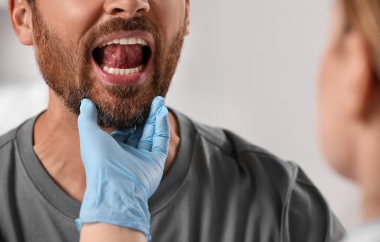 Man's mouth open during medical examination